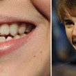 Justin Bieber hat eine Zahnspange Justin Bieber hat eine Zahnspange