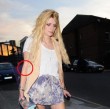 Mischa Barton mit roten Pusteln, die könnten auf Leberschäden hinweisen
