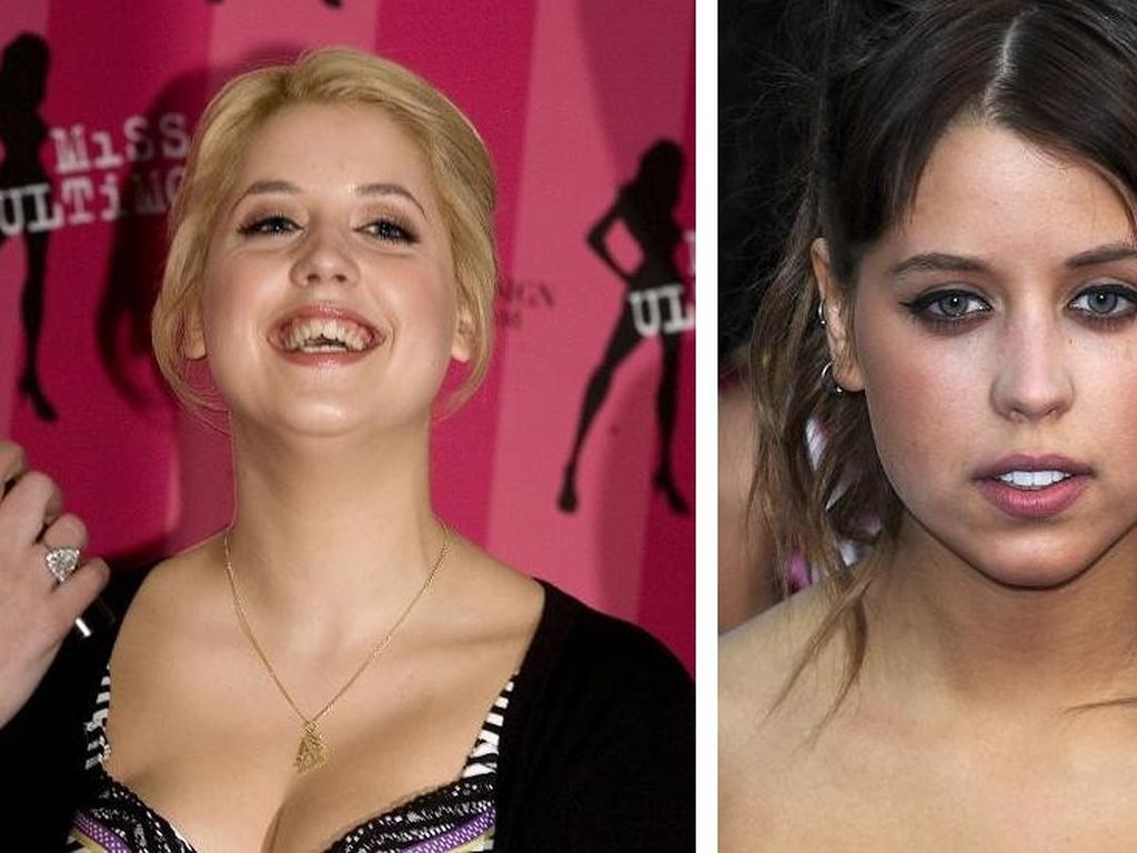 Trägt Peaches Geldof eine Zahnprothese? Promiflash.de