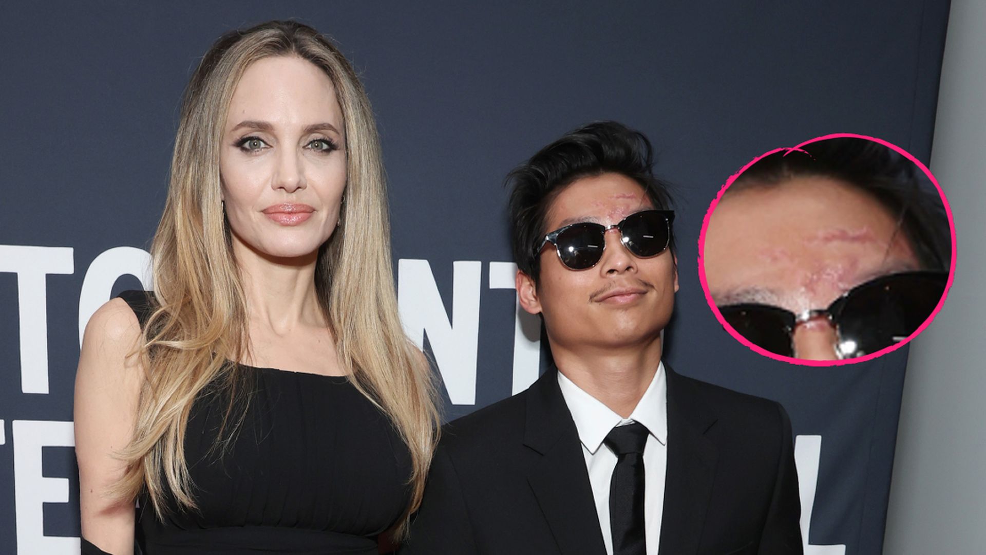Event-nach-Unfall-Pax-Jolie-Pitt-zeigt-Narben-im-Gesicht