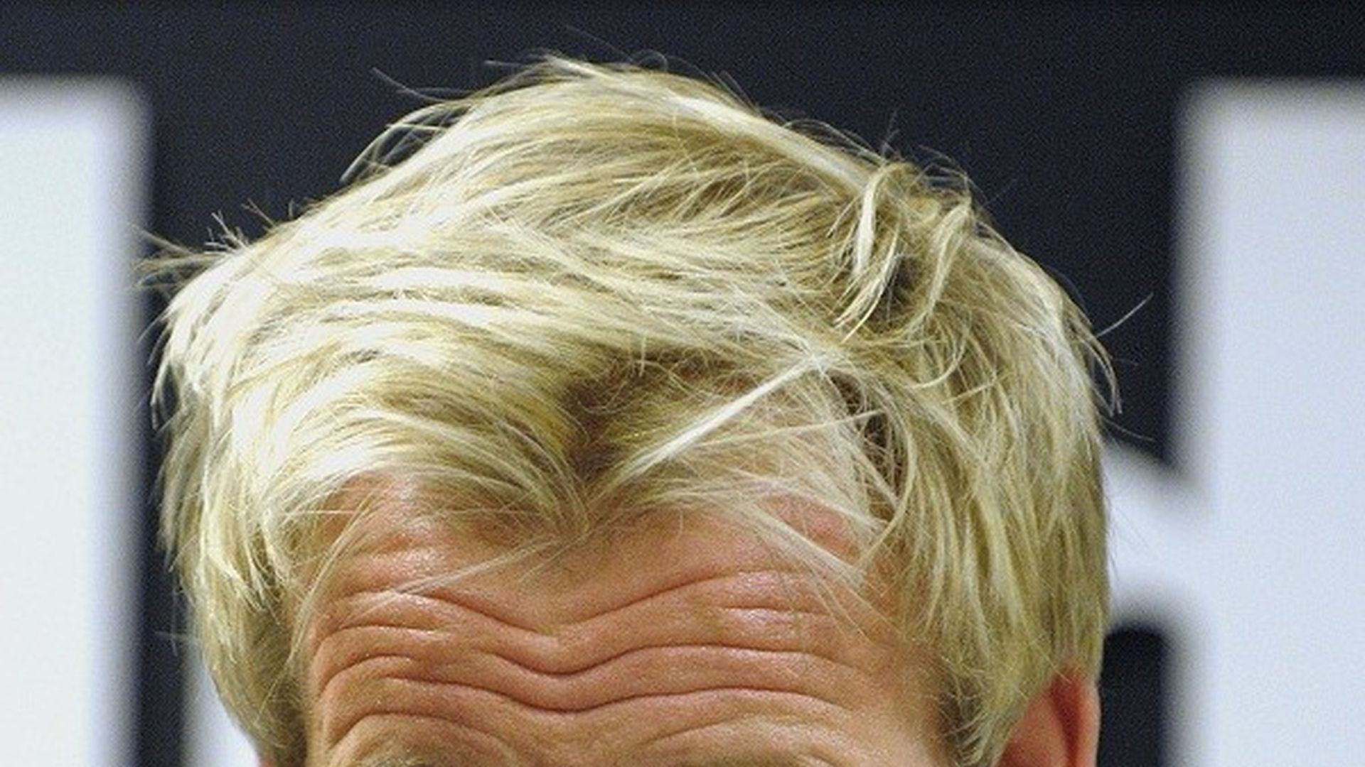 TVKoch Gordon Ramsay braucht HaarImplantate Promiflash.de