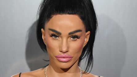 "Hängebacken": Darum hatte Iris Klein eine Schönheits-OP