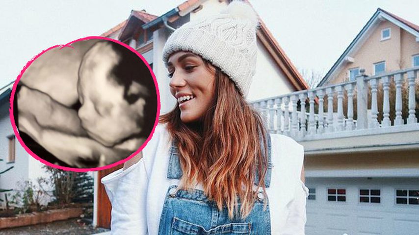 Schon so groß: Anna Maria Damm gibt Baby-Ultraschall-Update