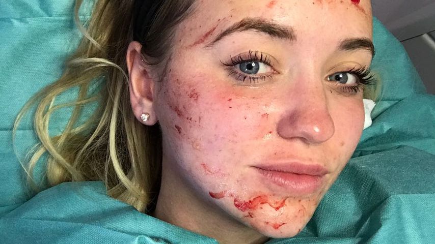 Vampir-Lifting: Cathy Lugner lässt sich beim Doc aufmotzen!