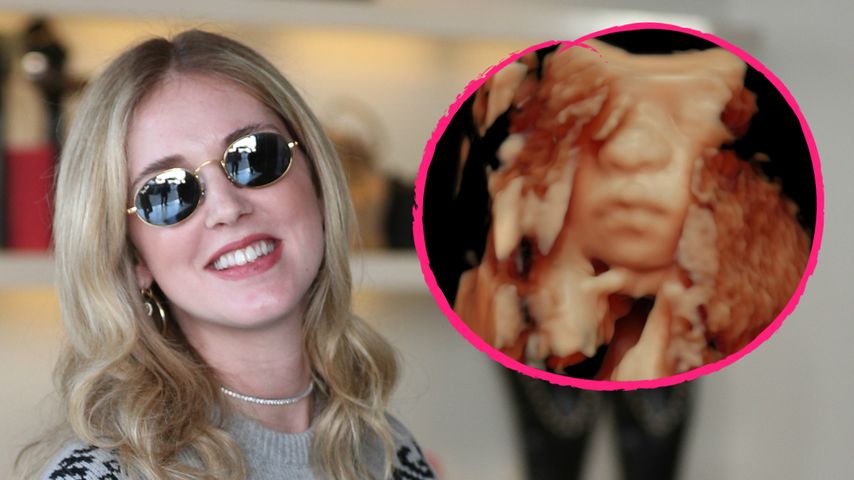 Chiara Ferragni: Ultraschall-Clip verrät Baby-Geschlecht