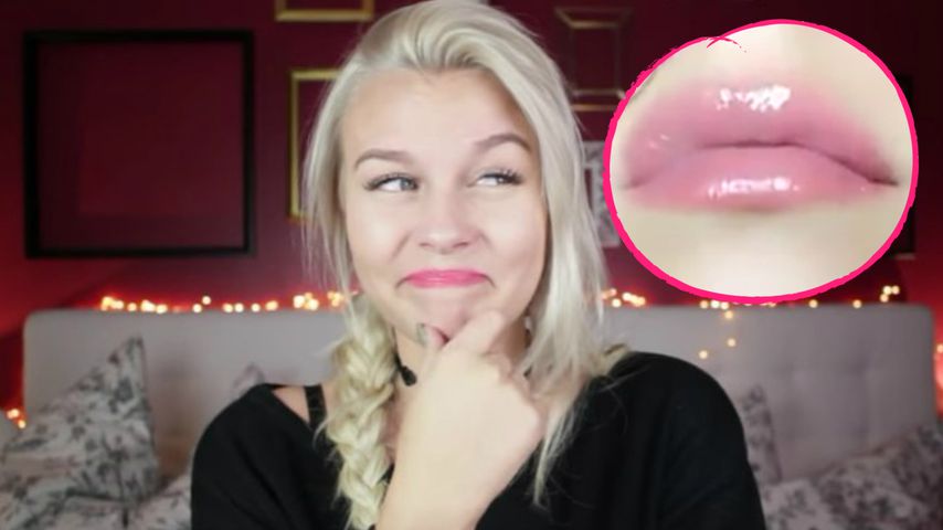 Beauty-Eingriff? Dagi Bee überrascht mit Monster-Lippen!