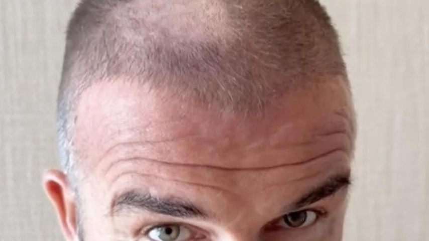 Kahle Stelle: David Beckham schneidet sich selbst Buzzcut
