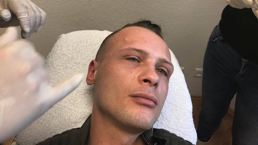 Emil Kusmirek beim Beauty-Doc