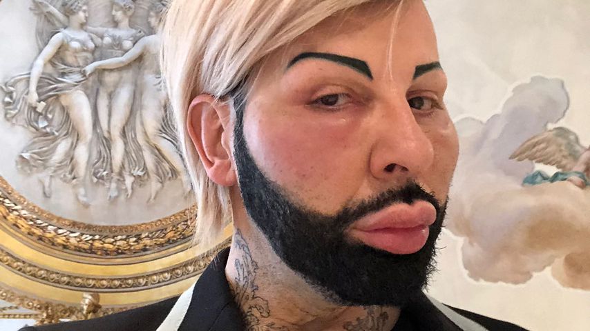 Nach heftigem Allergie-Schock: So geht es Harald Glööckler!