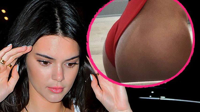 Plötzlich rund: Ließ sich Kendall Jenner den Po operieren?