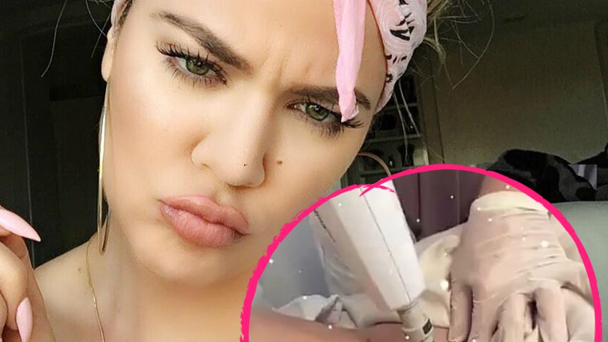 Autschi: Khloe Kardashian trennt sich von ihrem Arschgeweih!