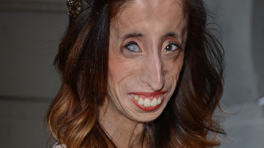 Lizzie Velasquez