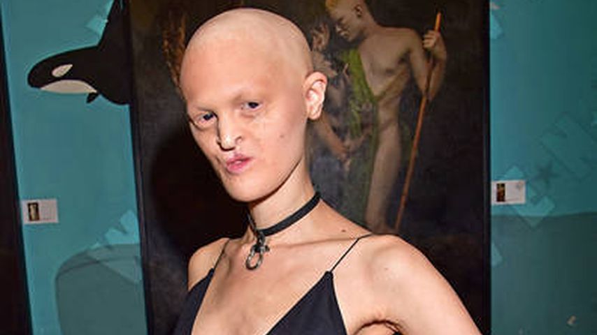 Model mit Erbkrankheit: Melanie Gaydos verzaubert Berlin!