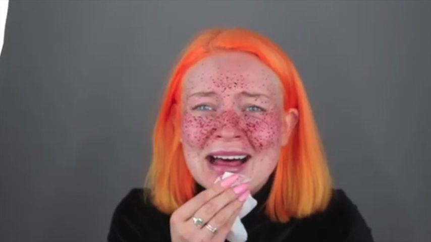 Nach Fake-Sommersprossen-Fail: YouTuberin "könnte weinen"