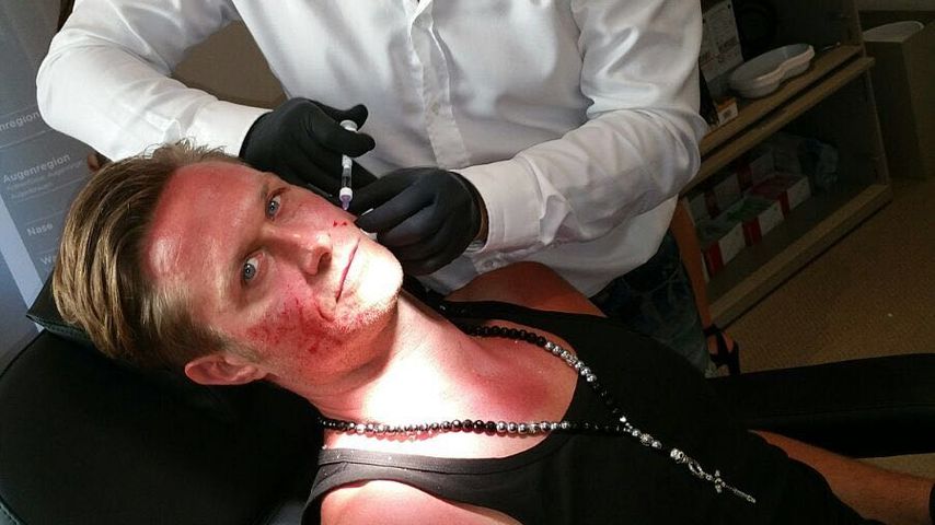 Nico Schwanz beim Beauty-Doc Oliver Gekeler