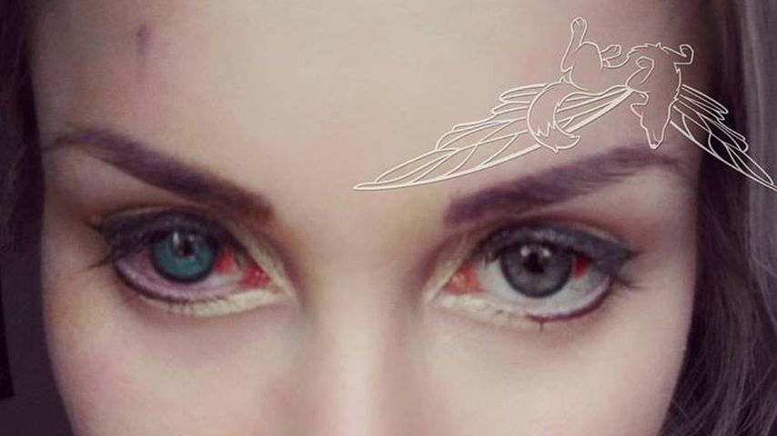 Pixee Fox mit blutunterlaufenen Augen nach ihrer Operation