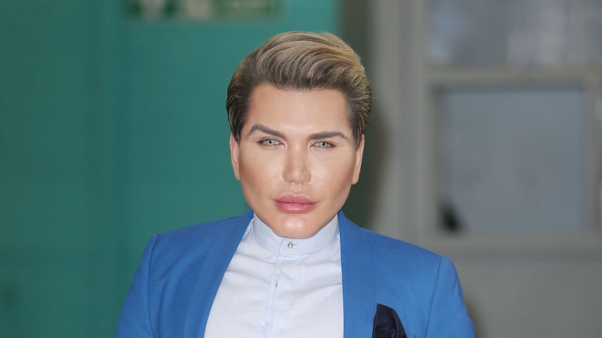 Real-Life-Ken Rodrigo: Gesicht mit Plazenta unterspritzt!