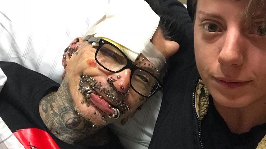 Auto-Crash! Piercing-Star bangte um seine Schmuckstücke