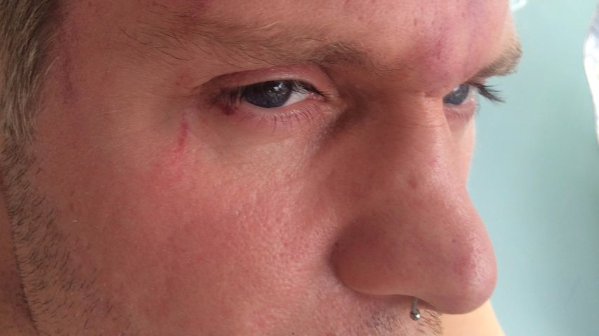 Steven Graf Bernadotte von Wisborg nach dem Übergriff