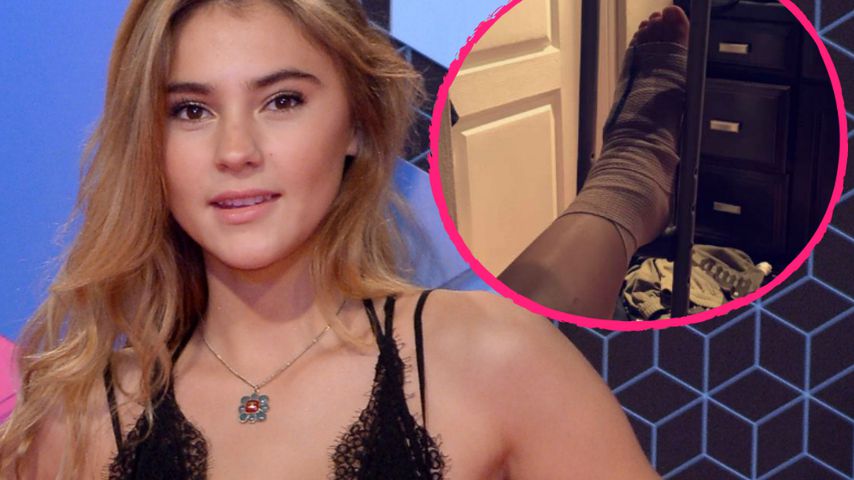 Coachella-Verletzung! Stefanie Giesinger verstaucht sich Fuß