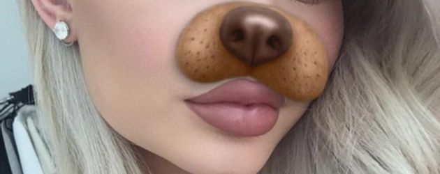 Kylie ist bekannt für ihre vollen Lippen Kylie ist bekannt für ihre vollen Lippen