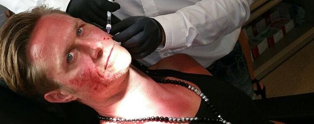 Nico Schwanz beim Beauty-Doc Oliver Gekeler Nico Schwanz beim Beauty-Doc Oliver Gekeler