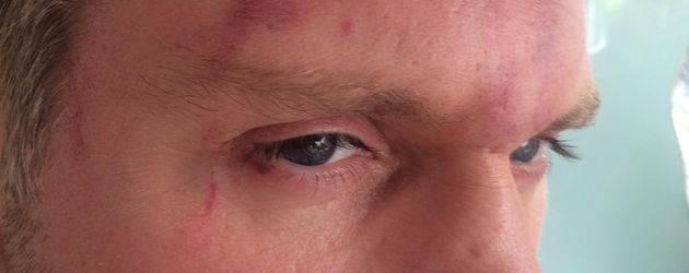 Steven Graf Bernadotte von Wisborg nach dem Übergriff Steven Graf Bernadotte von Wisborg nach dem Übergriff
